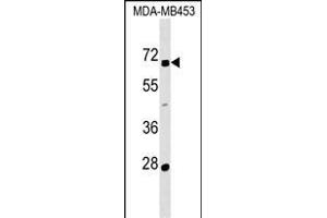 ZN Antibody (N-term) (ABIN1539545 and ABIN2849453) western blot analysis in MDA-M cell line lysates (35 μg/lane). (ZNF565 anticorps  (N-Term))