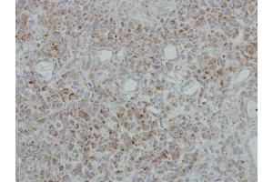 IHC-P Image Immunohistochemical analysis of paraffin-embedded HBL435 xenograft, using NDUFB5, antibody at 1:500 dilution.
