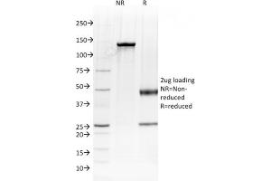 SDS-PAGE Analysis Purified Albumin Mouse Monoclonal Antibody (ALB/2144). (Albumin anticorps)