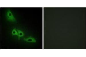 Immunofluorescence analysis of HeLa cells, using GK Antibody. (Glycerol Kinase anticorps  (AA 461-510))