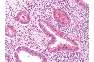Human, Uterus: Formalin-Fixed Paraffin-Embedded (FFPE)