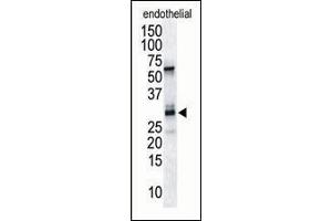 Antibody is used in Western blot to detect RCAN1/DSCR1 in endothelial tissue lysate.