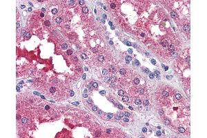 Anti-EDG3 / S1P3 antibody IHC of human kidney. (S1PR3 anticorps  (N-Term))