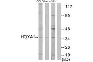 Western blot analysis of extracts from HeLa/COLO/293 cells, using HOXA1 Antibody. (HOXA1 anticorps  (AA 171-220))