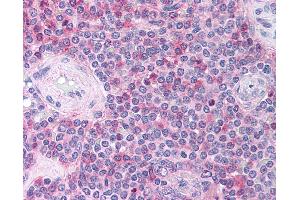 Anti-CCL18 antibody IHC of human spleen. (CCL18 anticorps  (C-Term))