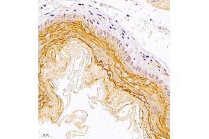 Immunohistochemistry of paraffin embedded mouse esophagus using TR2IT1 (ABIN7075887) at dilution of 1:1500 (400x lens) (TXNRD3NB anticorps)