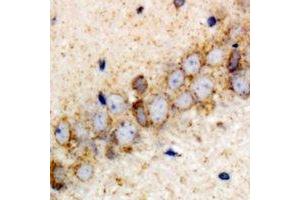 Immunohistochemical analysis of VPS37A staining in rat brain formalin fixed paraffin embedded tissue section. (VPS37A anticorps)