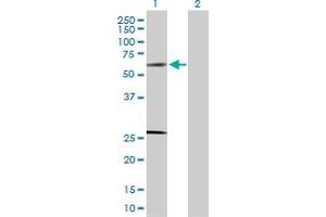 Western Blot analysis of SOCS4 expression in transfected 293T cell line by SOCS4 MaxPab polyclonal antibody. (SOCS4 anticorps  (AA 1-440))