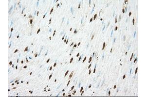 Image no. 3 for anti-Acetyl-CoA Acetyltransferase 2 (ACAT2) antibody (ABIN1496398)