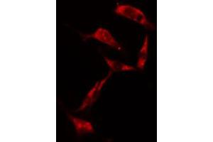 ABIN6274203 staining NIH-3T3 cells by IF/ICC.