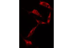 ABIN6274203 staining NIH-3T3 cells by IF/ICC. (RPS6KB1 anticorps  (C-Term))