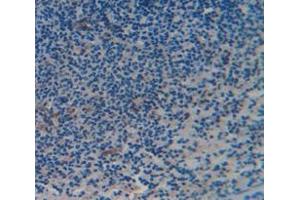 IHC-P analysis of Kidney tissue, with DAB staining. (CD6 anticorps  (AA 477-644))