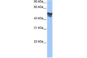 WASF3 antibody used at 1 ug/ml to detect target protein. (WASF3 anticorps  (Middle Region))