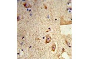 Formalin-fixed and paraffin-embedded human brain tissue reacted with Destrin Antibody , which was peroxidase-conjugated to the secondary antibody, followed by DAB staining.