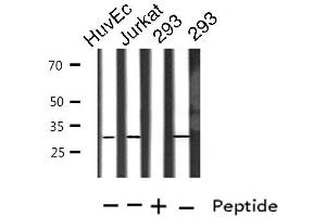 Western blot analysis of extracts from HuvEc/Jurkat/293 cells, using TOLLIP antibody. (TOLLIP anticorps  (Internal Region))