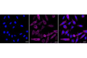 Immunocytochemical staining of Hela cells with Moesin antibody (ABIN7799482), 1:1,000). (Recombinant Moesin anticorps)