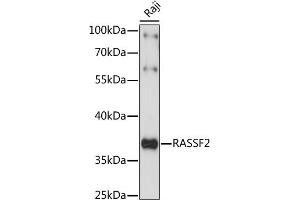 Western blot analysis of extracts of Raji cells, using R antibody (ABIN7269859) at 1:1000 dilution.