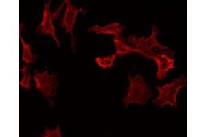 ABIN6275143 staining COLO205 by IF/ICC.