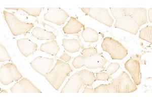 Detection of GSTA4 in Human Skeletal muscle Tissue using Polyclonal Antibody to Glutathione S Transferase A4 (GSTA4)