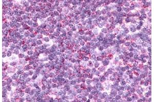 Anti-CCR9 antibody  ABIN1048405 IHC staining of human thymus, lymphocytes. (CCR9 anticorps  (Cytoplasmic Domain))