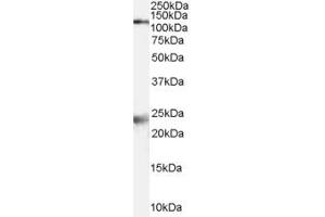ABIN185678 (2µg/ml) staining of Rat Brain lysate (35µg protein in RIPA buffer).