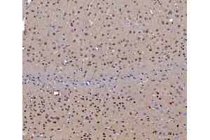 IHC analysis of CEP250 using anti-CEP250 antibody (ABIN7602053). (CEP250 anticorps  (AA 563-853))
