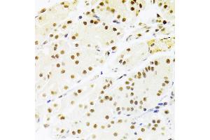 Immunohistochemistry of paraffin-embedded human stomach using RBPJKK Antibody (ABIN6131815, ABIN6146805, ABIN6146806 and ABIN6221327) at dilution of 1:100 (40x lens).