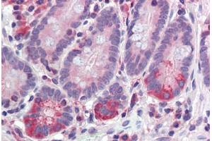 Human Small Intestine (formalin-fixed, paraffin-embedded) stained with  antibody ABIN462272 followed by biotinylated secondary antibody, alkaline phosphatase-streptavidin and chromogen. (TDP1 anticorps  (AA 1-298))