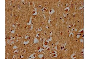 IHC image of ABIN7171265 diluted at 1:300 and staining in paraffin-embedded human brain tissue performed on a Leica BondTM system. (STXBP5 anticorps  (AA 515-610))