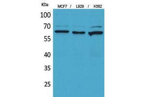 Western Blotting (WB) image for anti-5'-Nucleotidase, Ecto (CD73) (NT5E) (Internal Region) antibody (ABIN3178285) (CD73 anticorps  (Internal Region))