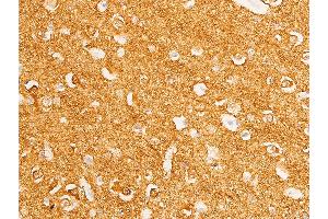 ABIN6267272 at 1/100 staining human brain tissue sections by IHC-P.