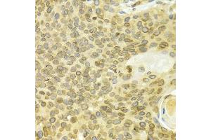 Immunohistochemistry (IHC) image for anti-Lamin B1 (LMNB1) (AA 397-586) antibody (ABIN3015698)