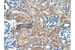 SDCBP antibody was used for immunohistochemistry at a concentration of 4-8 ug/ml to stain Epithelial cells of renal tubule (arrows) in Human Kidney.