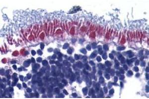 Immunohistochemistry of AIF in human retina with AIF antibody at 10 μg/ml.