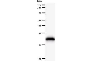 Western Blotting (WB) image for anti-Histidyl-tRNA Synthetase (HARS1) antibody (ABIN933100) (HARS1/Jo-1 anticorps)