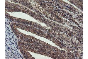 Image no. 2 for anti-Crystallin, Zeta, Homolog antibody (ABIN1497658) (CRYZL1 anticorps)