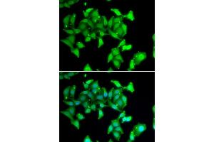 Immunofluorescence analysis of U20S cell using MYO1C antibody. (Myosin IC anticorps)