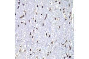 Immunohistochemistry of paraffin-embedded mouse brain using Lyn antibody (ABIN5998158) at dilution of 1/100 (40x lens). (LYN anticorps)