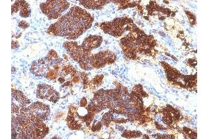 Formalin-fixed, paraffin-embedded human Parathyroid Gland stained with PTH Mouse Monoclonal Antibody (PTH/1175). (PTH anticorps  (AA 32-115))