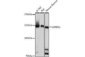 Western blot analysis of extracts of various cell lines, using C Rabbit mAb (ABIN7266125) at 1:1000 dilution. (CARD11 anticorps)