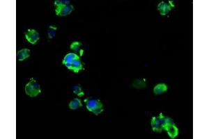 Immunofluorescence staining of MCF-7 cells with ABIN7144635 at 1:133, counter-stained with DAPI. (ARRDC1 anticorps  (AA 288-433))