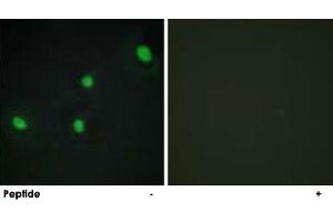 Immunofluorescence analysis of HepG2 cells, using CDCA4 polyclonal antibody . (CDCA4 anticorps)