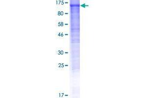 Image no. 1 for DDHD Domain Containing 1 (DDHD1) (AA 1-872) protein (GST tag) (ABIN1351268)