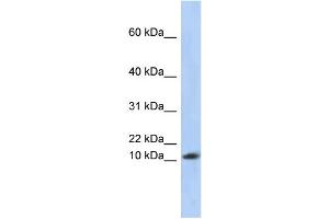 WB Suggested Anti-RPL30 Antibody Titration: 0. (RPL30 anticorps  (Middle Region))