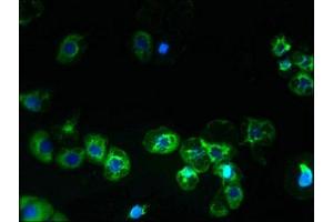 Immunofluorescent analysis of A431 cells using ABIN7169964 at dilution of 1:100 and Alexa Fluor 488-congugated AffiniPure Goat Anti-Rabbit IgG(H+L)