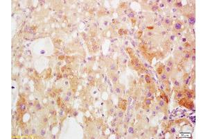 Formalin-fixed and paraffin embedded rat liver tissue labeled Anti-HMGB1 Polyclonal Antibody, Unconjugated  at 1:400, followed by conjugation to the secondary antibody and DAB staining (HMGB1 anticorps  (AA 75-170))