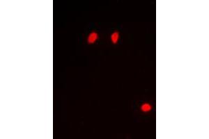 Immunofluorescent analysis of Histone H3 (pS10) staining in Raw264. (Histone 3 anticorps  (pSer10))