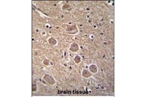 anti-Tumor Protein P53 Inducible Nuclear Protein 1 (TP53INP1) (AA 36-64), (N-Term) antibody