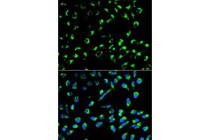 Immunofluorescence analysis of MCF7 cell using SFN antibody. (14-3-3 sigma/SFN anticorps  (AA 1-248))