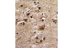 anti-Adrenergic, alpha-1B-, Receptor (ADRA1B) (AA 270-297) antibody